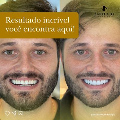 Zanelato Estética Dental | Tratamentos Odontológicos e Odontologia Digital foto 3